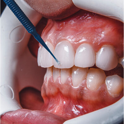 Bartels & Bartels Ihre Zahngesundheit liegt uns am Herzen